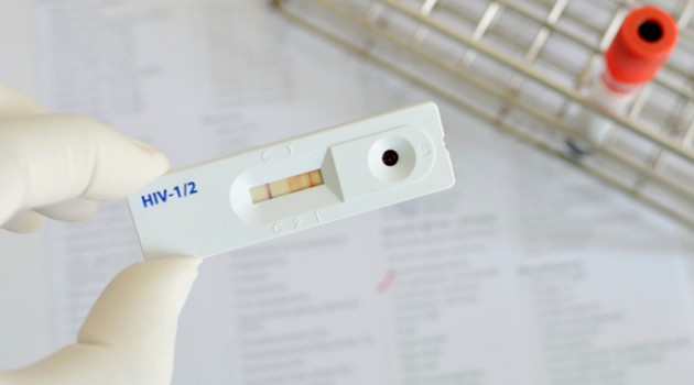 hiv teste