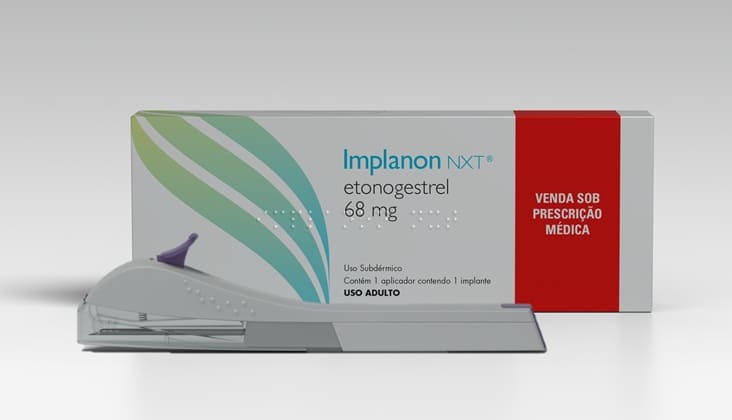 Anvisa amplia uso do Implanon NXT para cinco anos e uso imediato após o parto