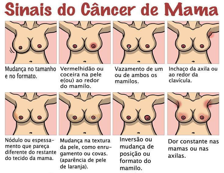 sinais do cancer de mama
