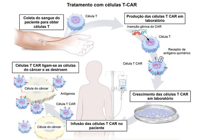 tcar celula cancer 1