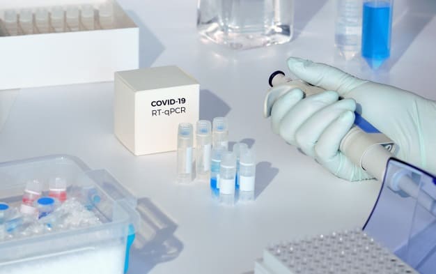 teste exame coronavirus