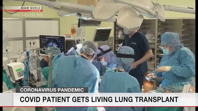 transplante pulmao coronavirus